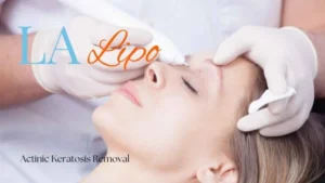 Woman receiving Actinic Keratosis Removal Treatment Ruislip Gardens