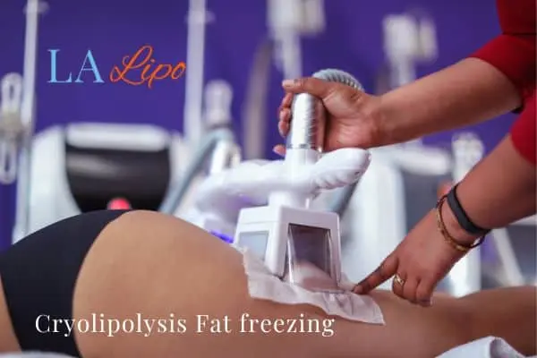 women getting fat freezing Ruislip Gardens