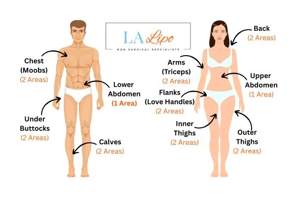 LA LIPO Cryolipolysis Areas Ruislip Gardens