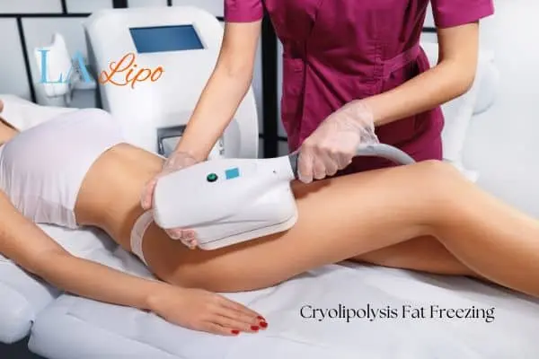 Woman receiving coolsculpting Ruislip Gardens treatment on her thighs