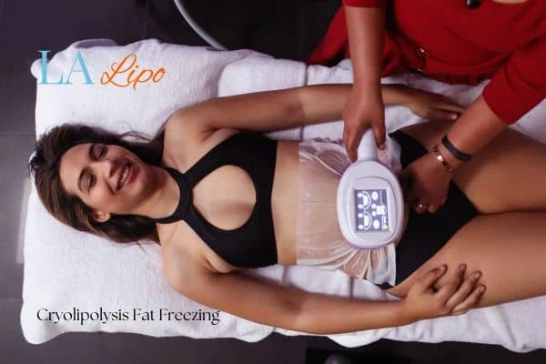 woman getting cryolipolysis Ruislip Gardens